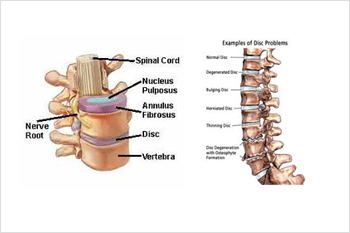 cervical root